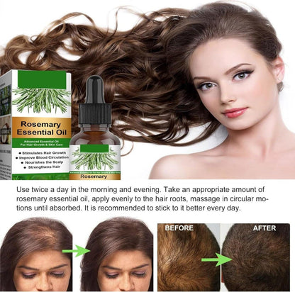 Rosemary Flourish Oil for Hair Growth 30ml